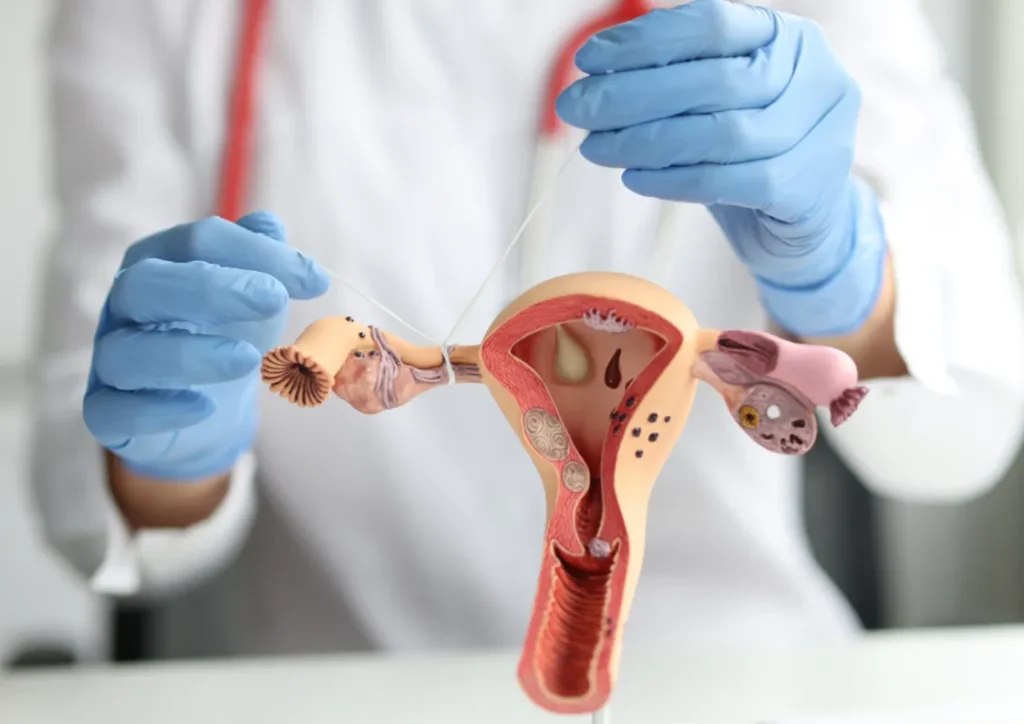 Tubal Ligation reversal