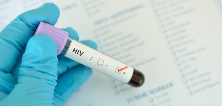 Living Well with HIV-Treatment and Support from LOCAL MD
