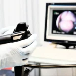 How to Prepare for Your Upper Endoscopy Procedure?