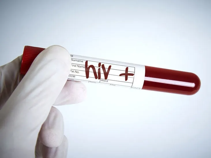 Emergency Preparedness for People With HIV