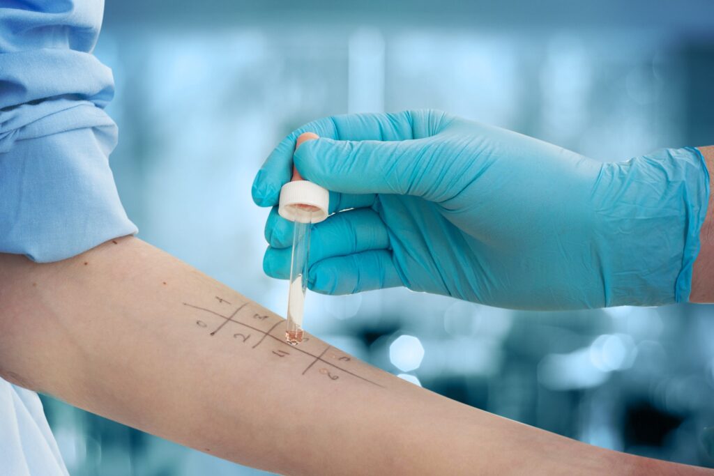 Misdiagnosed or Missed? Why Allergy Diagnosis Often Gets Delayed