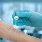 Misdiagnosed or Missed? Why Allergy Diagnosis Often Gets Delayed