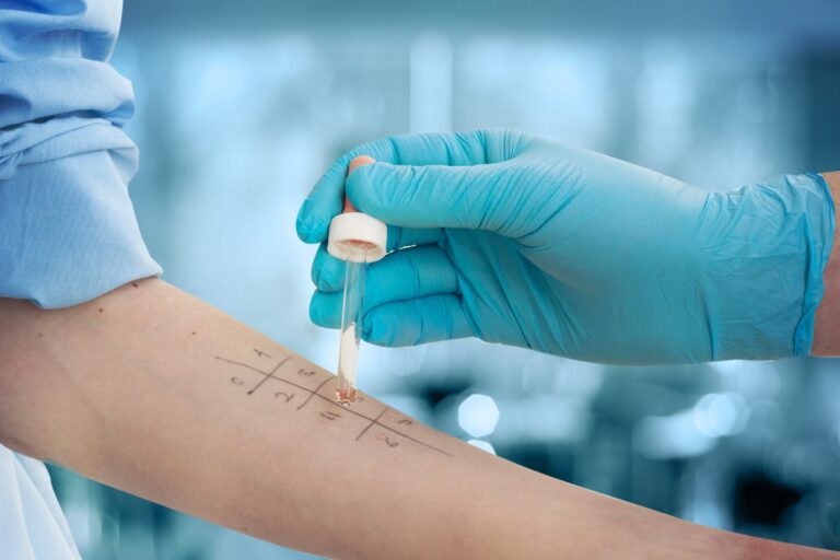Misdiagnosed or Missed? Why Allergy Diagnosis Often Gets Delayed
