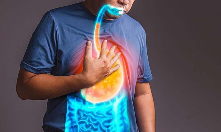 How Sleeping Position Can Influence Acid Reflux Symptoms