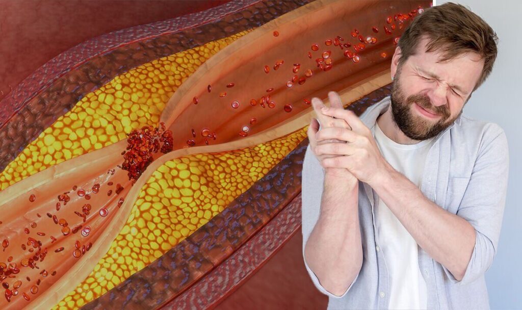 Why Ongoing Chronic Care Is Important for High Cholesterol Patients in Brooklyn